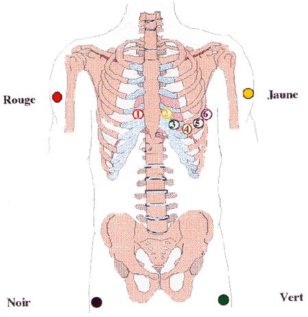 ecg electrode